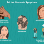 Scalp with hair loss symptoms illustration - trichotillomania overview