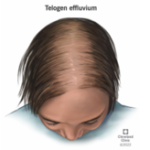 Scalp with visible hair thinning before hair loss treatment
